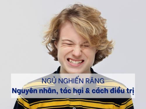 Ngủ nghiến răng: Nguyên nhân, tác hại & cách điều trị 9 Ngủ nghiến răng: Nguyên nhân, tác hại & cách điều trị