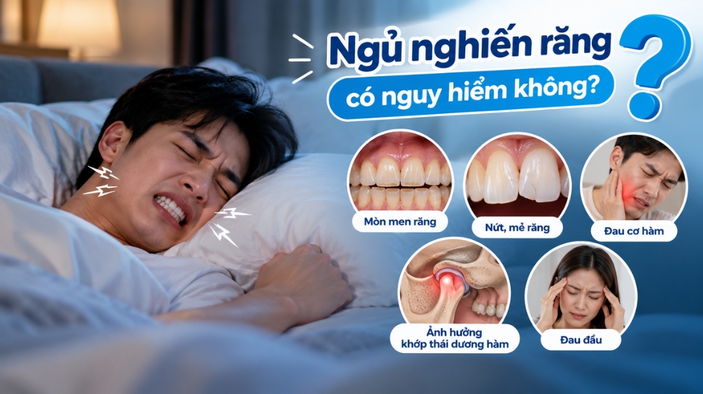 Ngủ nghiến răng có nguy hiểm không?
